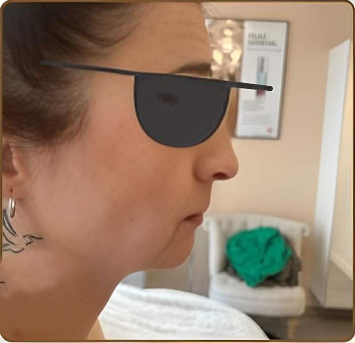 Avant Picsart AiImageEnhancer